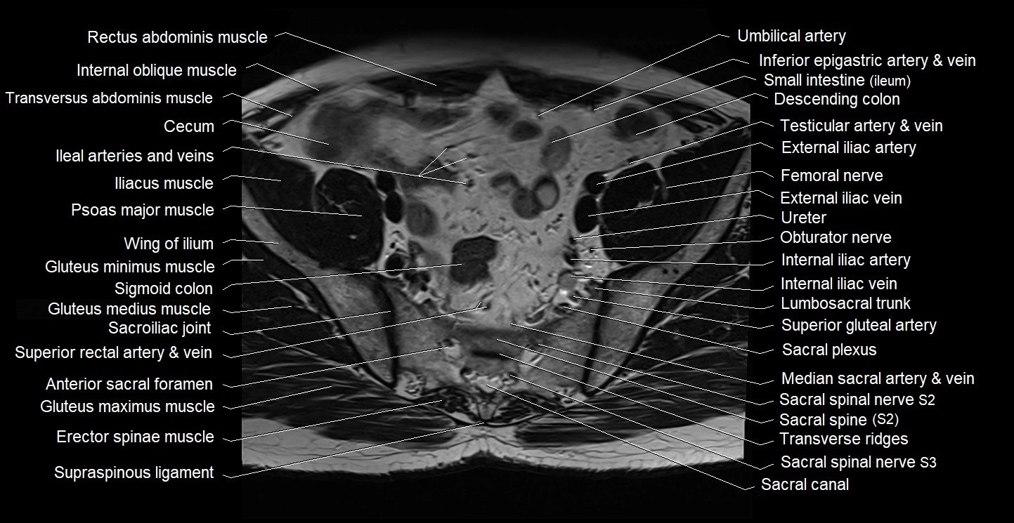 Male pelvis axial cross sectional anatomy image 8.webp